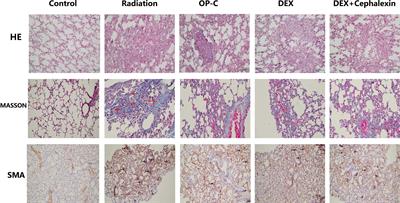 The Effect of Ophiopogonin C in Ameliorating Radiation-Induced Pulmonary Fibrosis in C57BL/6 Mice: An Update Study